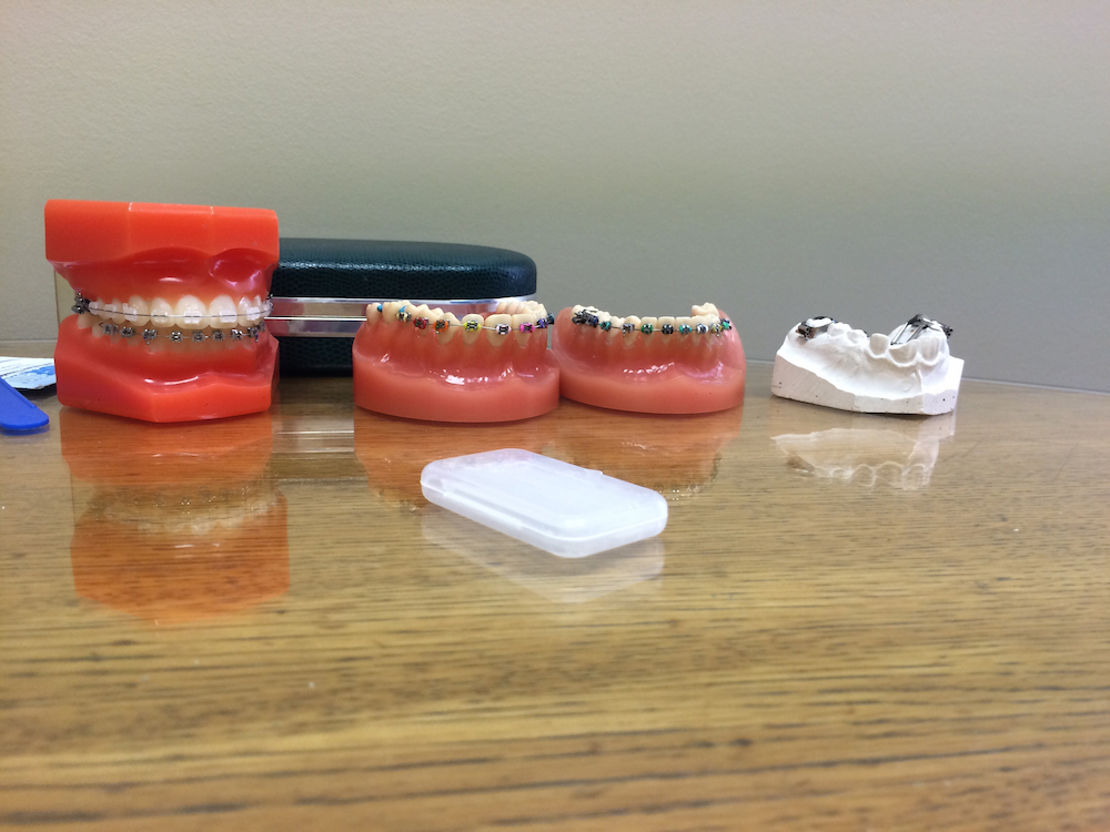 at the orthodontist with displayed molds samples 2022 11 11 16 50 12 utc 1
