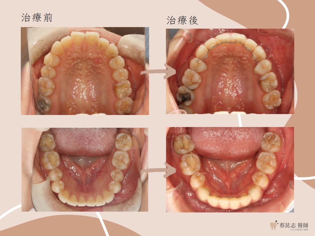 orthodontics case3 7