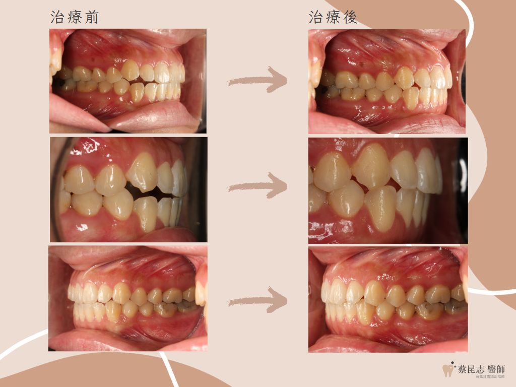 orthodontics case4 4