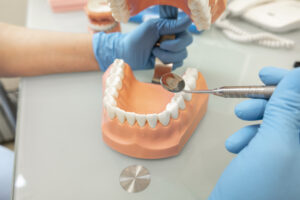 plastic human teeth models and dental model of tee 2022 11 10 09 40 24 utc 1