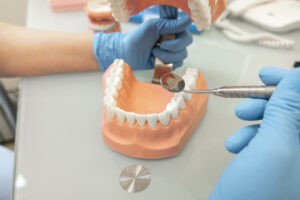 首頁 42 plastic human teeth models and dental model of tee 2022 11 10 09 40 24 utc 1