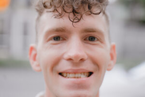 portrait of a smiling guy with misaligned bite 2022 11 16 22 23 07 utc 1