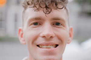首頁 44 portrait of a smiling guy with misaligned bite 2022 11 16 22 23 07 utc 1