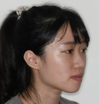 陳小姐 04 1