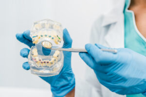 cropped view of dental jaw model in hands of stoma 2023 11 27 05 17 42 utc