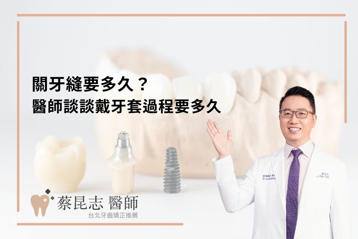 Read more about the article 關牙縫要多久？醫師談談戴牙套過程要多久