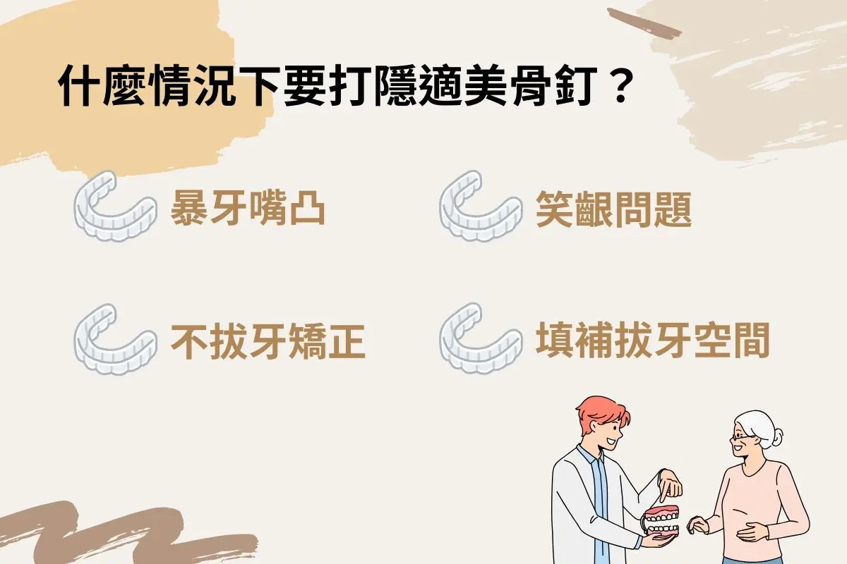 應該避免隱適美骨釘嗎,醫師說出骨釘厲害之處 1 什麼情況下要打隱適美骨釘