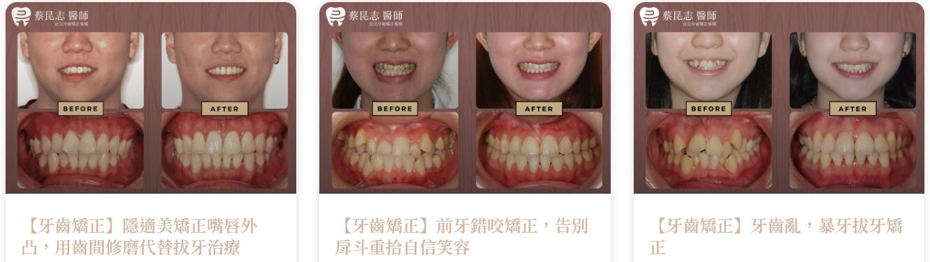 矯正案例