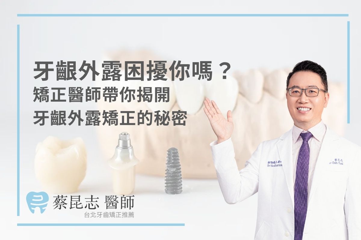 牙齦外露困擾你嗎?矯正醫師帶你揭開牙齦外露矯正的秘密