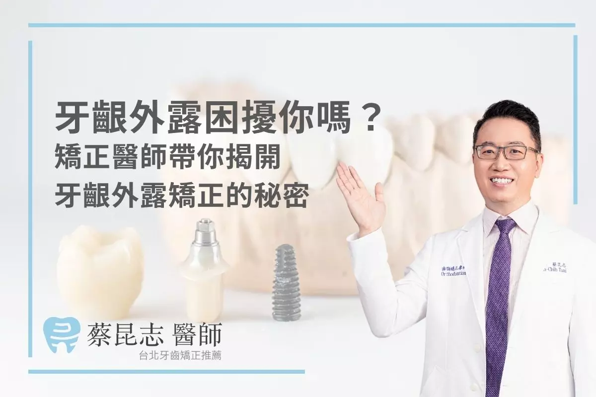 牙齦外露困擾你嗎？矯正醫師帶你揭開牙齦外露矯正的秘密