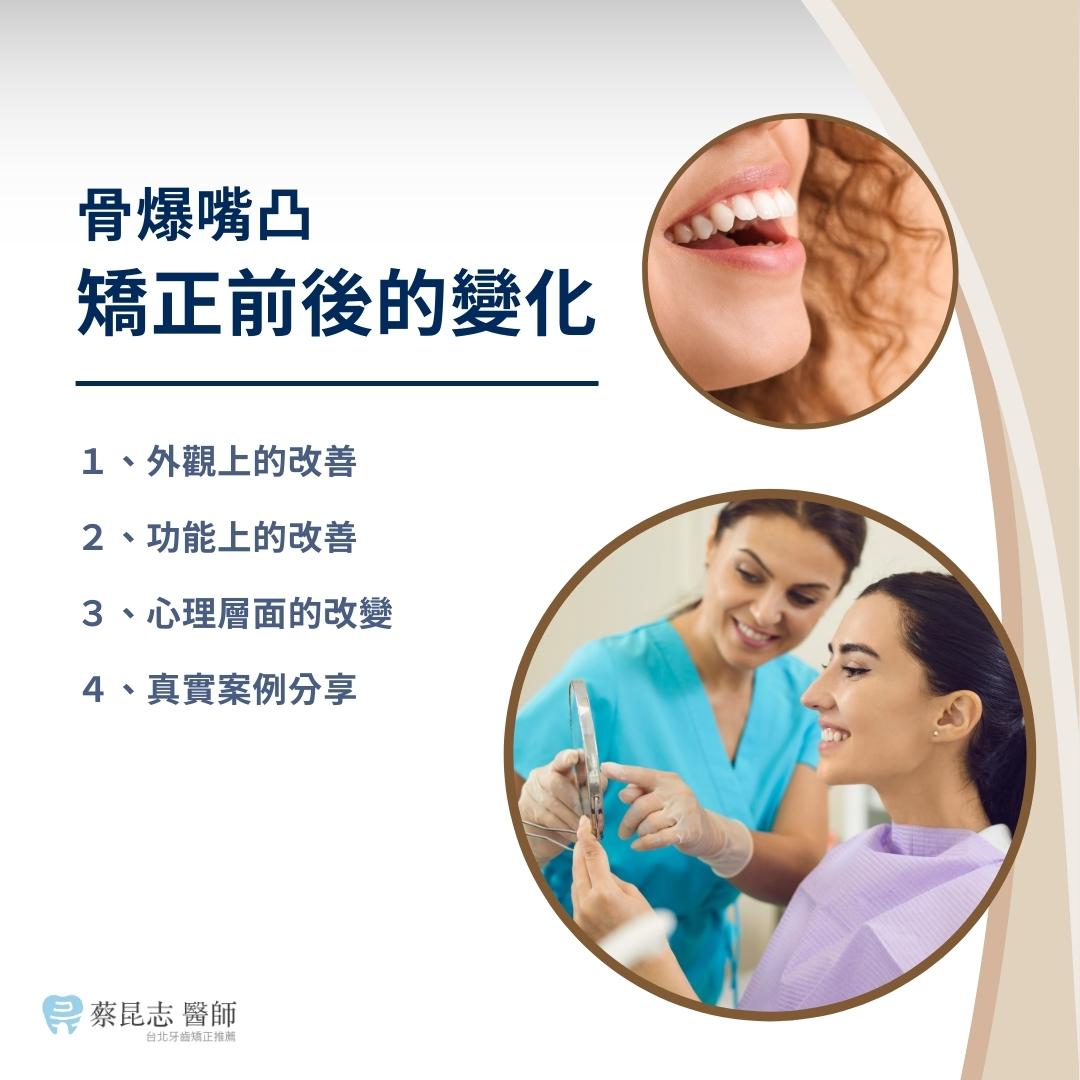 骨爆嘴凸矯正前後的變化