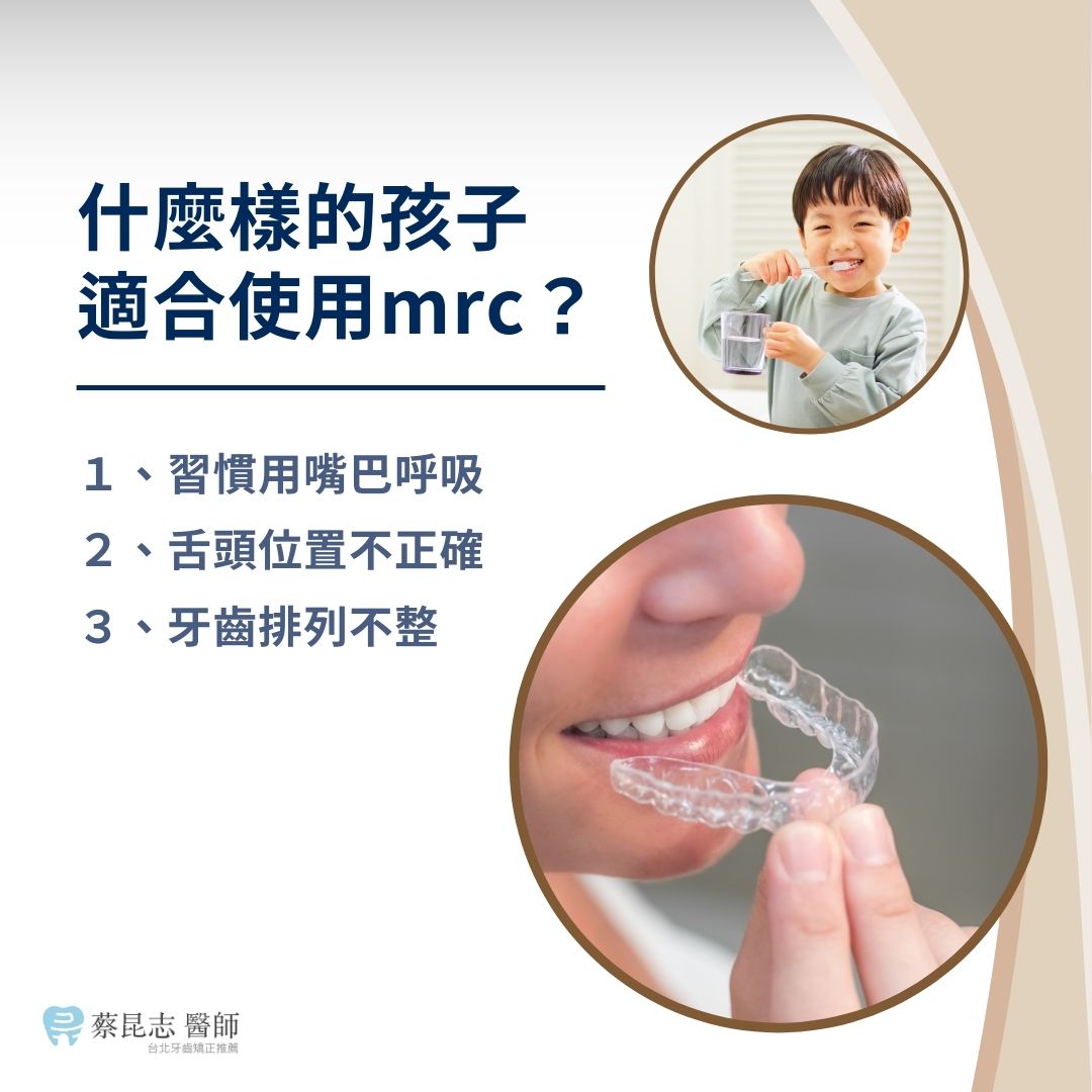 mrc兒童矯正有效嗎?幫你完整解析4大重點 1 什麼樣的孩子適合使用mrc?