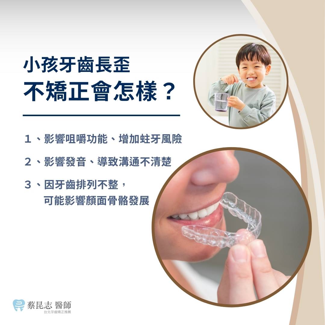 小孩牙齒長歪,不矯正會怎樣?