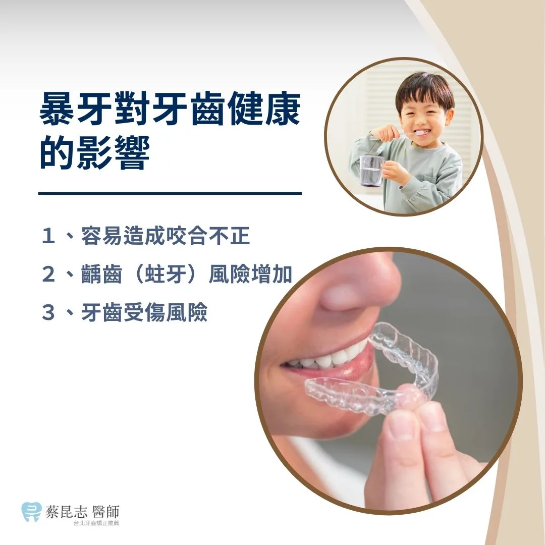 暴牙對牙齒健康的影響
