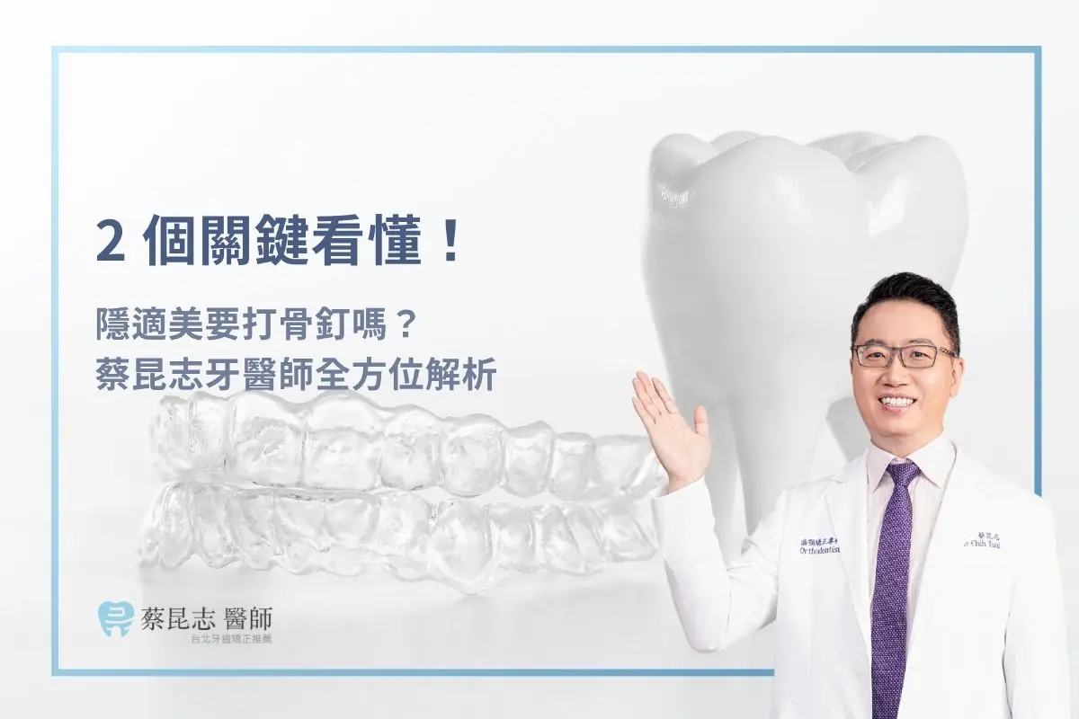 2 個關鍵看懂！隱適美要打骨釘嗎？蔡昆志牙醫師全方位解析