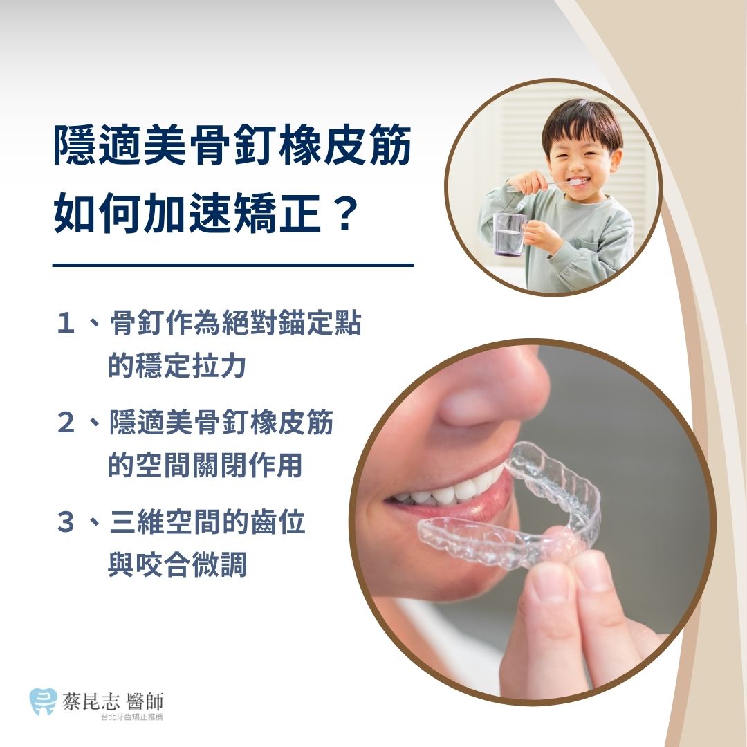 隱適美骨釘橡皮筋如何加速矯正？