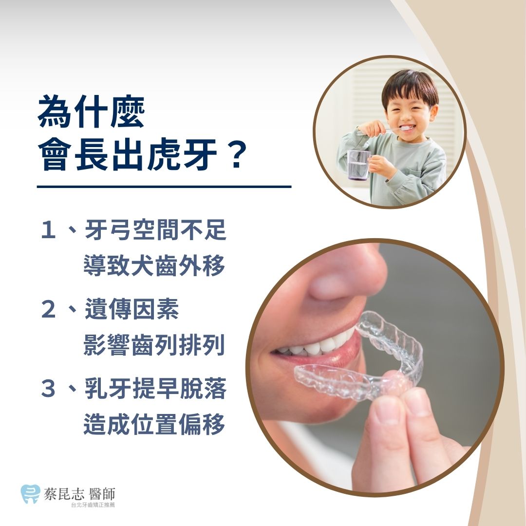 為什麼會長出虎牙？