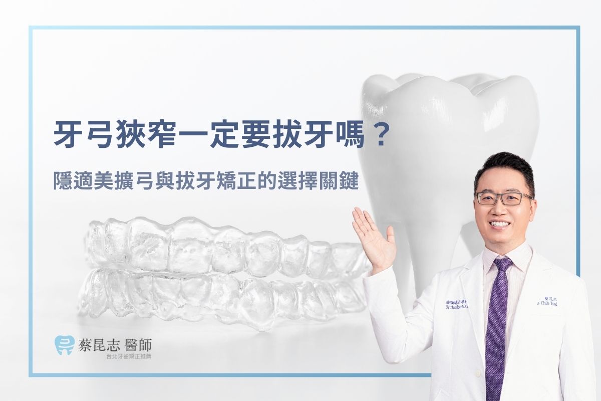 首頁 9 牙弓狹窄一定要拔牙嗎?隱適美擴弓與拔牙矯正的選擇關鍵